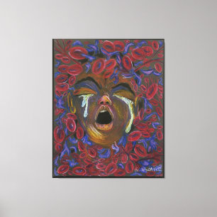 Tio omdefinierad - Viktighet för sicklecellsmärtan Canvastryck