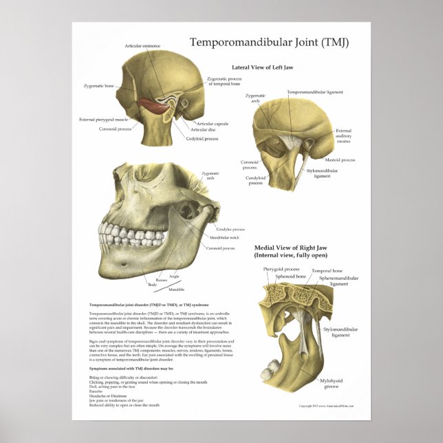 TMJ Joint Syndrome Anatomy Medical Poster (Framsidan)
