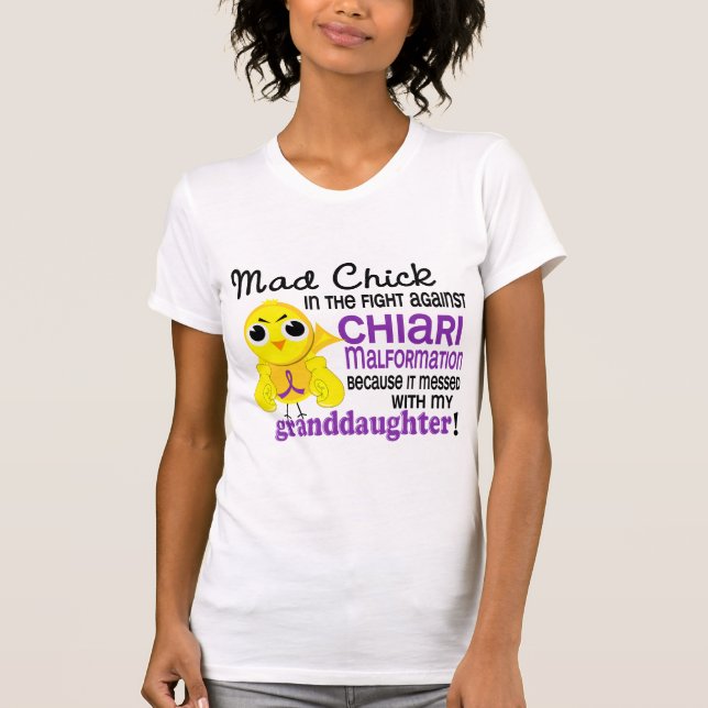 Tokig sondotterChiari för chick 2 Malformation T Shirt (Framsida)