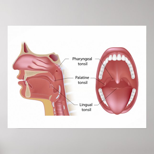 Tonsils Poster (Framsidan)