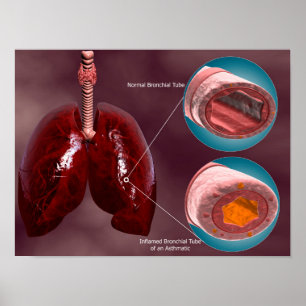 Trachea Kor-sektion med lungar Poster