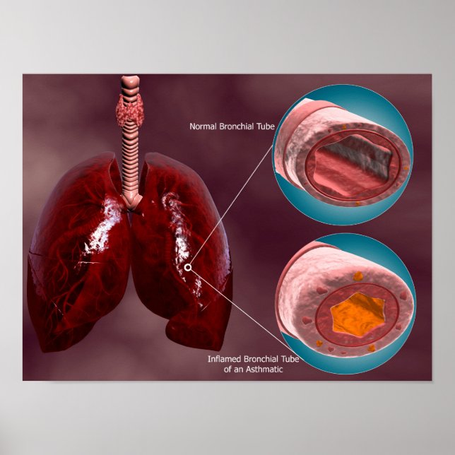 Trachea Kor-sektion med lungar Poster (Framsidan)