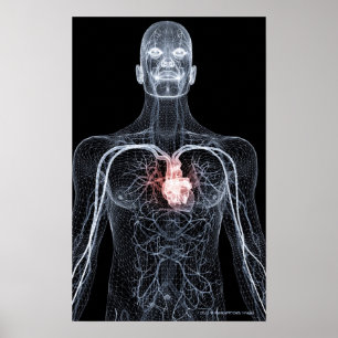 Trådform i blodkärlen i övre delen av kroppen 2 poster