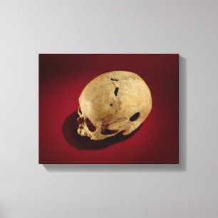 Trepanerad skalle canvastryck