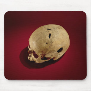 Trepanerad skalle musmatta