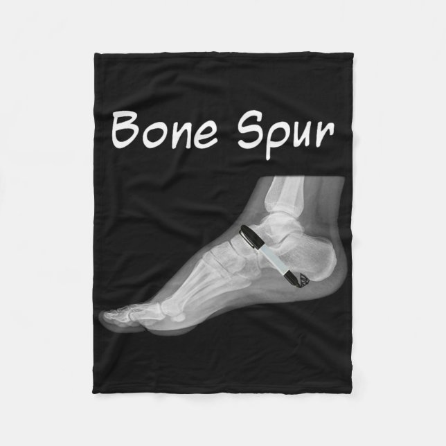 Trump Bone Spur Ink Pen Funny Anti Trump  Fleecefilt (Framsidan)