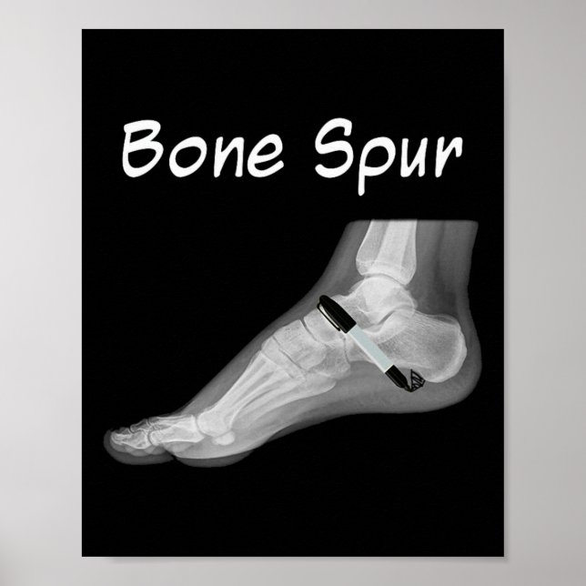 Trump Bone Spur Ink Pen Funny Anti Trump  Poster (Framsidan)