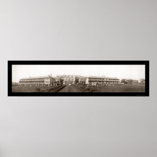 Tuberculosis Liverpool Photo 1912 Poster