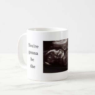 Ultraljudsfoto Far kommer att bli det bästa Pappa Kaffemugg