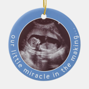 Ultraljudsfoto Pojke Blue Miracle i Skapar Julgransprydnad Keramik