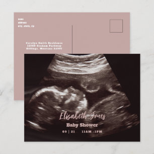 Ultraljudsfoto Rosa Baby Shower Meddelande Vykort