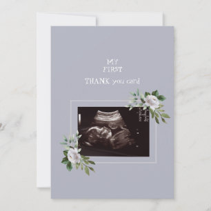 Ultrasound Photo Girl Baby Point of View i Tack Kort