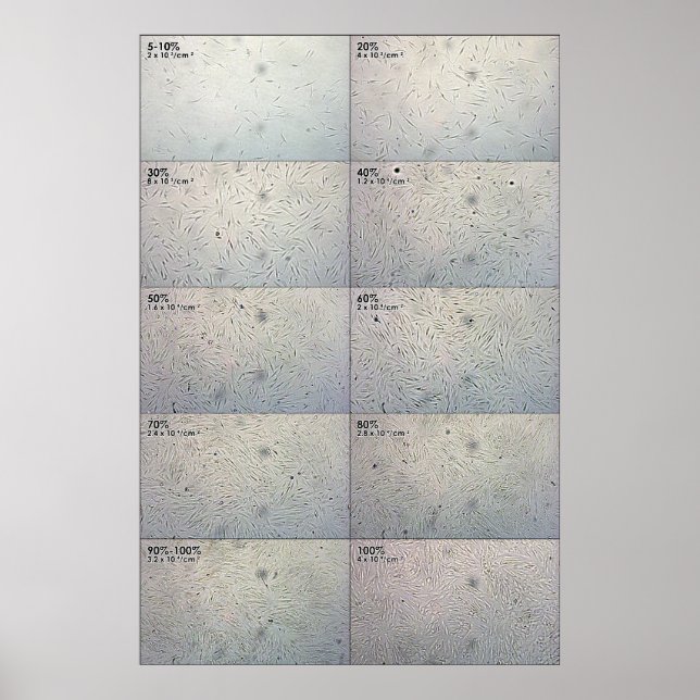 Uppföljningsdiagram för sammanträffande poster (Framsidan)