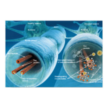 Upplösning av mikrotubuli i en neuron