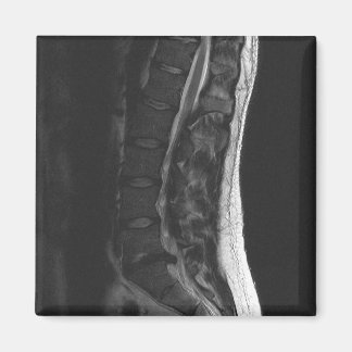 Upplöst diskmagnet magnet