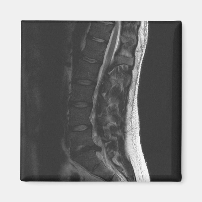 Upplöst diskmagnet magnet (Framsidan)