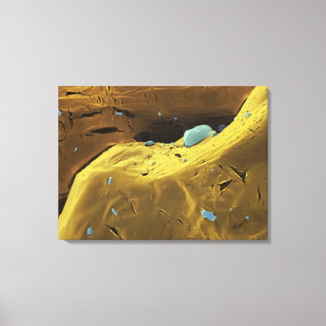 Urea pulver canvastryck (Framsida)