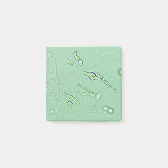 Urinalys Yast Microscope laboratoriebild Post-it Block (Framsida)