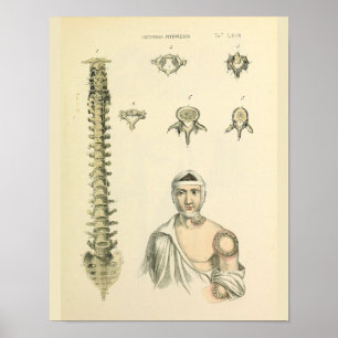 Utskrift av ryggradspalten Vertebrae Anatomy Art Poster