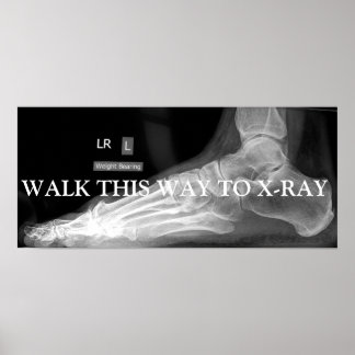 VÄLJ DET HÄR SÄTTET FÖR ATT X-RAY POSTER