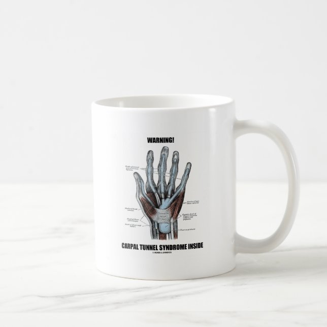 Varning! Carpal Tunnel Syndrome Inside (Anatomy) Kaffemugg (Höger)