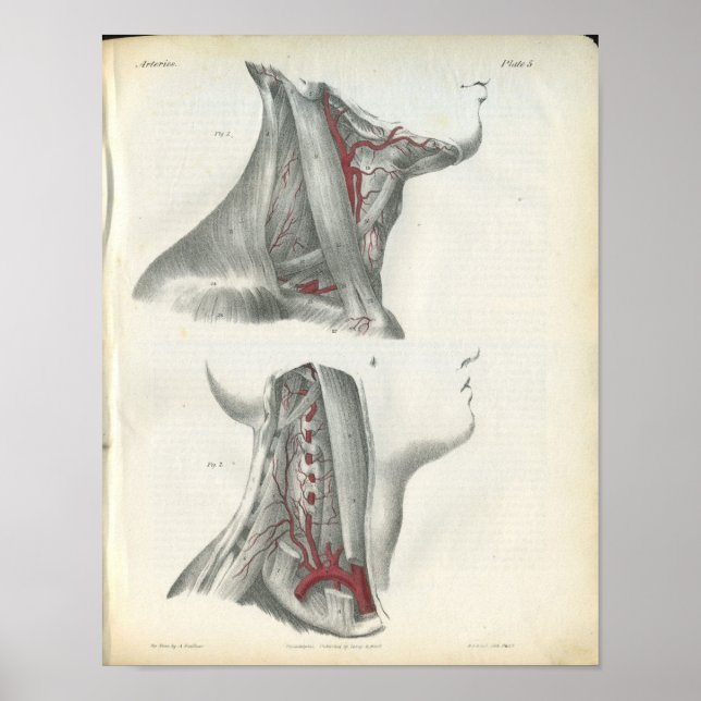 Vertebral Arteries Nacke Anatomy Skriv ut Poster (Framsidan)