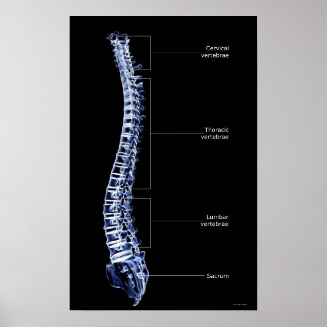 Vertebral kolumn 3 poster (Framsidan)