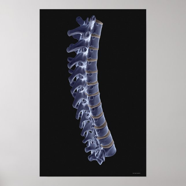Vertebral kolumn 3 poster (Framsidan)