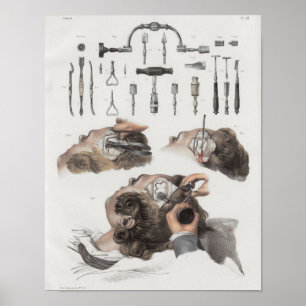 Vintage av hjärnkirurgi Instruments Anatomy Print Poster