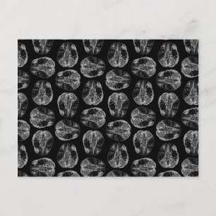 Vintage Brain Diagram Skriv ut Mönster Brains Blac Vykort