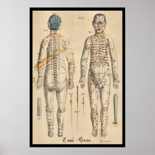 Vintage Fransk 1825 Acupuncture Meridian Points Poster