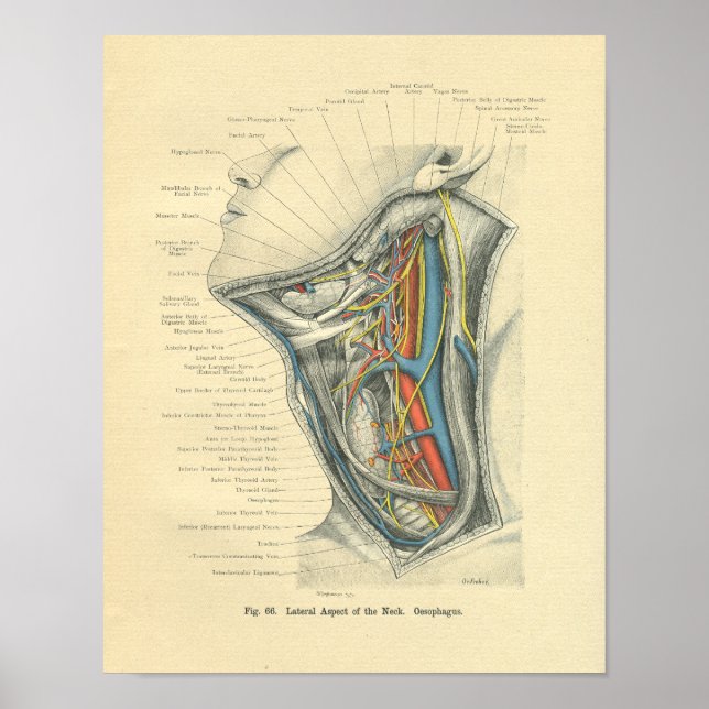 Vintage Frohse Anatomical Lateral Nacke Poster (Framsidan)