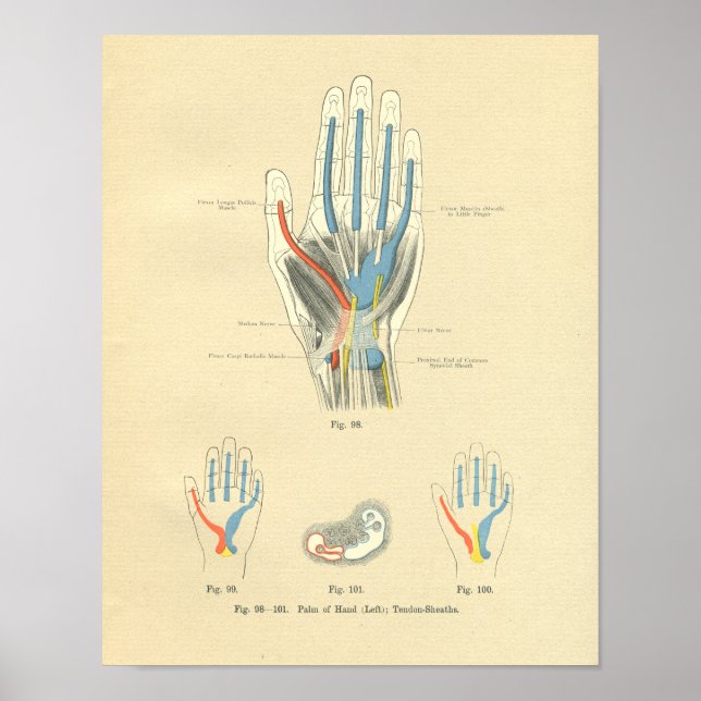 Vintage Frohse Anatomy of Hand & Tendons Poster (Framsidan)