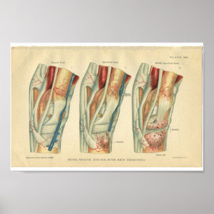 Vintage Horse Anatomy Print of Leg Poster