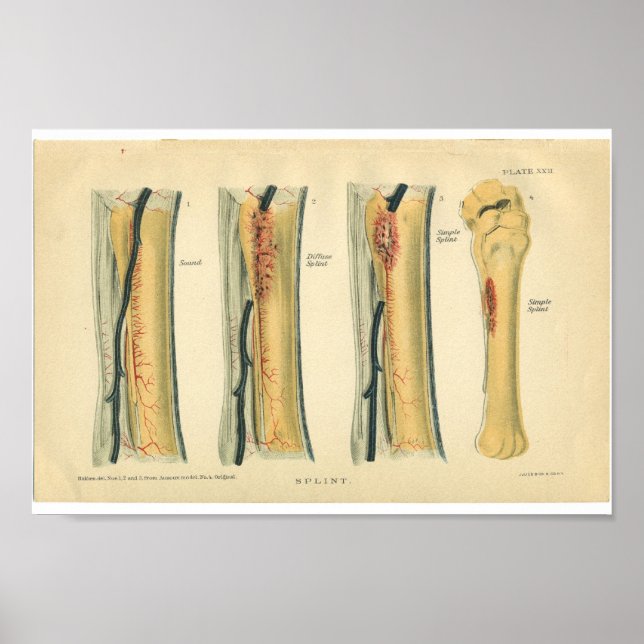 Vintage Horse Anatomy Print Splint Poster (Framsidan)