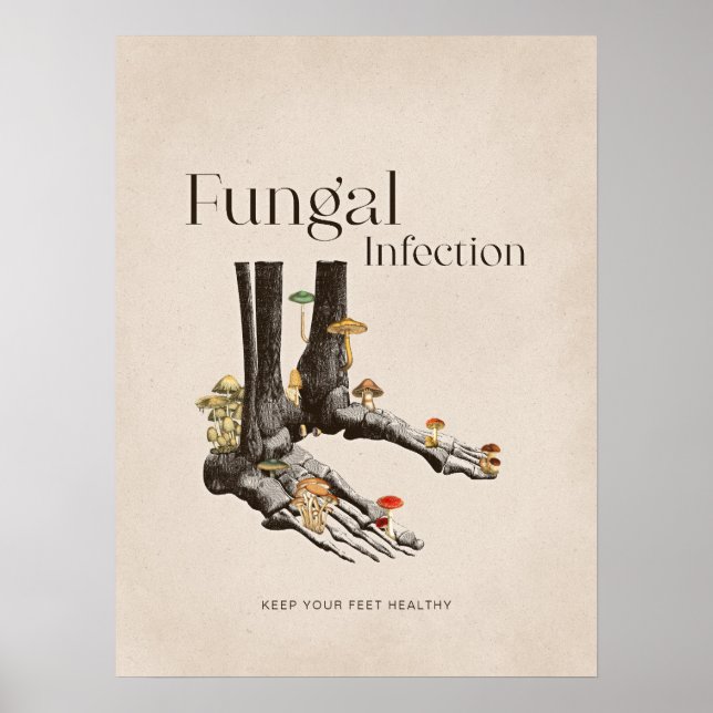 Vintage Svampinfektion Fottvård Poster (Framsidan)