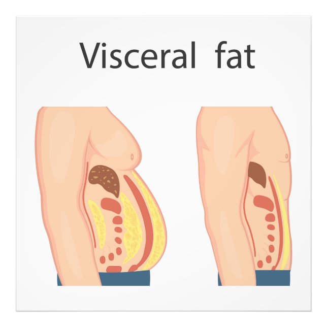 Visceral tjock fototryck (Framsidan)