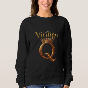 Vitiligo Royalty T Shirt