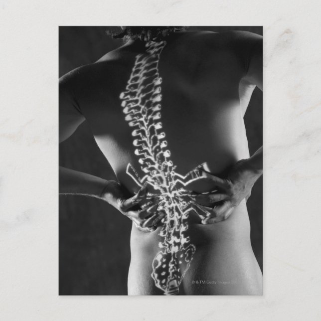 Vy över ryggmärgssladd vykort (Framsida)