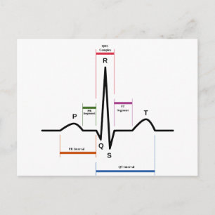 vykort Sinus-rytm Electrokardiogram EKG