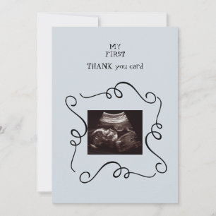 Whimsical Ultrasound Baby Point of View Tack Kort