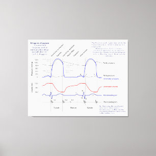 Wiggers Diagram Canvastryck