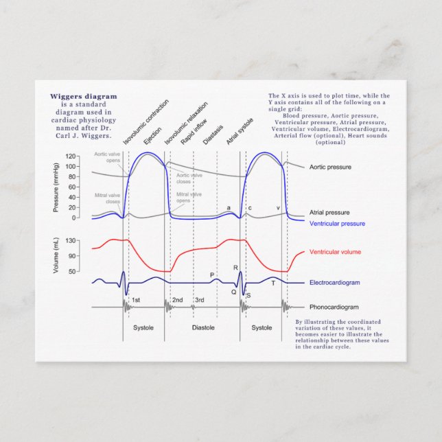 Wiggers Diagram Vykort (Framsida)