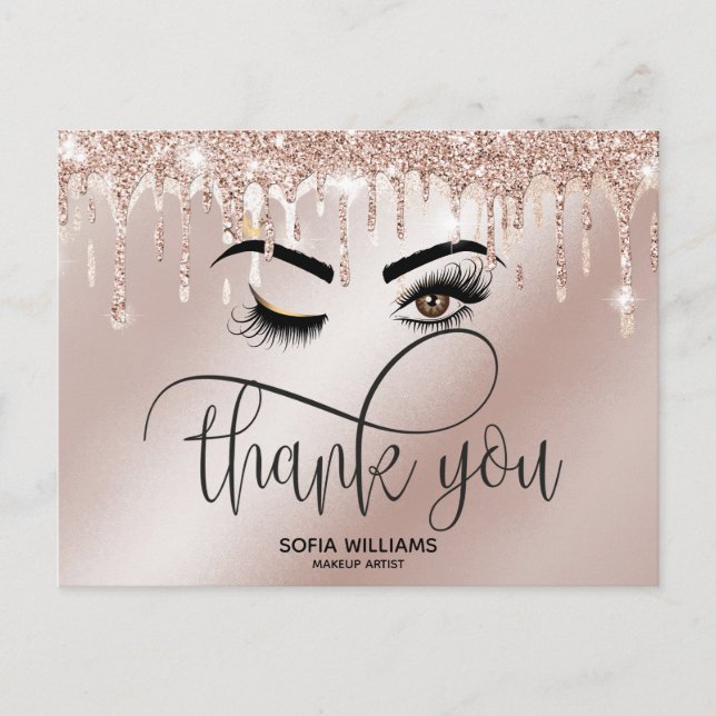 Wink BeSnyval Brown Öga med Guld Krona Vykort (Framsida)