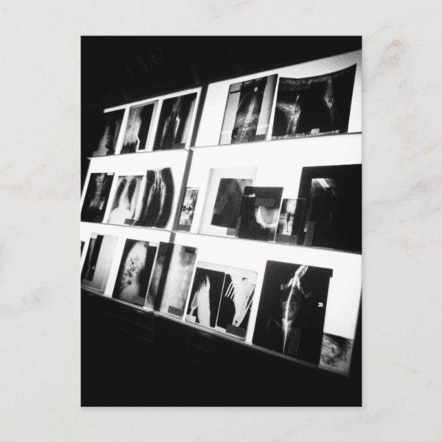 X-radarkort Vykort (Framsida)