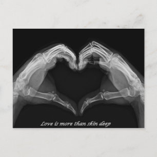 X-Ray Art Vykort