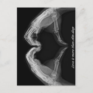 X-Ray Art Vykort