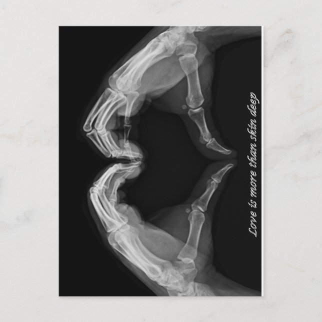 X-Ray Art Vykort (Framsida)