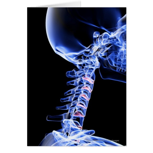X-ray avbildar av benen av nacken hälsningskort (Framsidan)