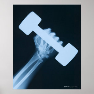 X-ray avbildar av människa räcker med väger, poster